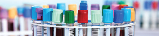 Close-up of colorful sample tubes arranged in lab centrifuge rotor – Qor Labs guide to choosing centrifuges